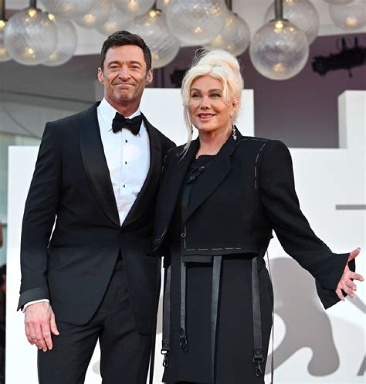 
Deborra Lee Furness Plastic Surgery Needs To Stop Says Her 13-Years-Younger Husband Hugh Jackman 