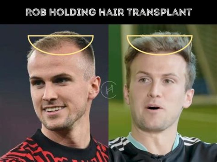 
Does Rob Holding Have New Hair? Fans Notice Something Different About The Arsenal Player 