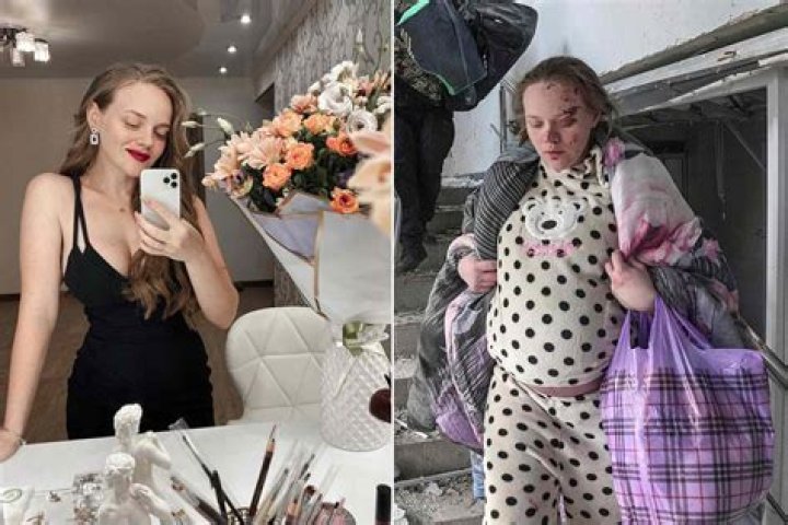 
Instagram Blogger Mariana Vishegirskaya Gave Birth After Hospital Bombing In Ukraine, 