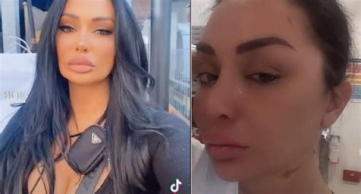 
Meet Jenny Elhassan, Tiktok Star Victim Of Acid Attack, Here Are More Details on Her 