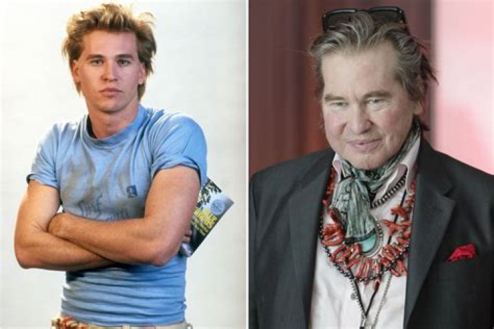 Truth About Val Kilmer’s Health: Did He Smoke or Have Cancer?